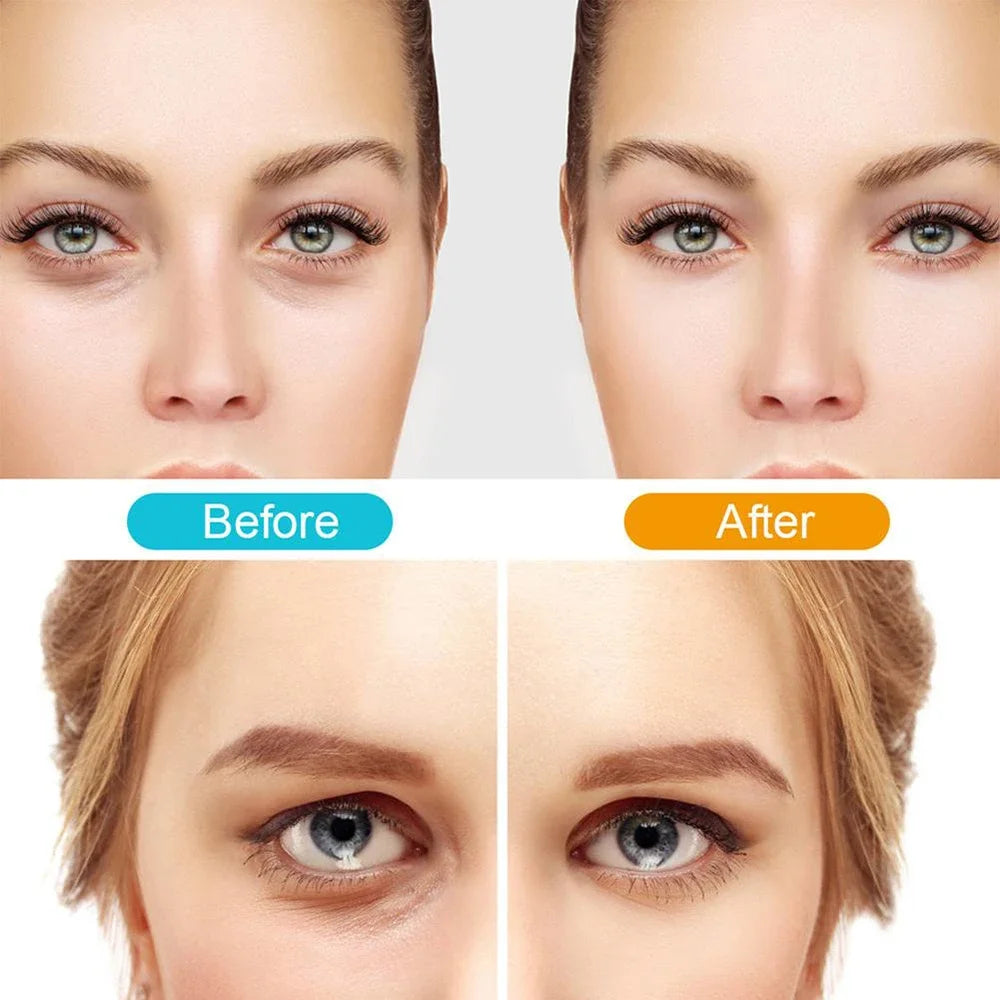 2-in-1 Red Light Therapy + EMS To Erase Eye Bags