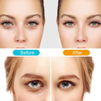 2-in-1 Red Light Therapy + EMS To Erase Eye Bags