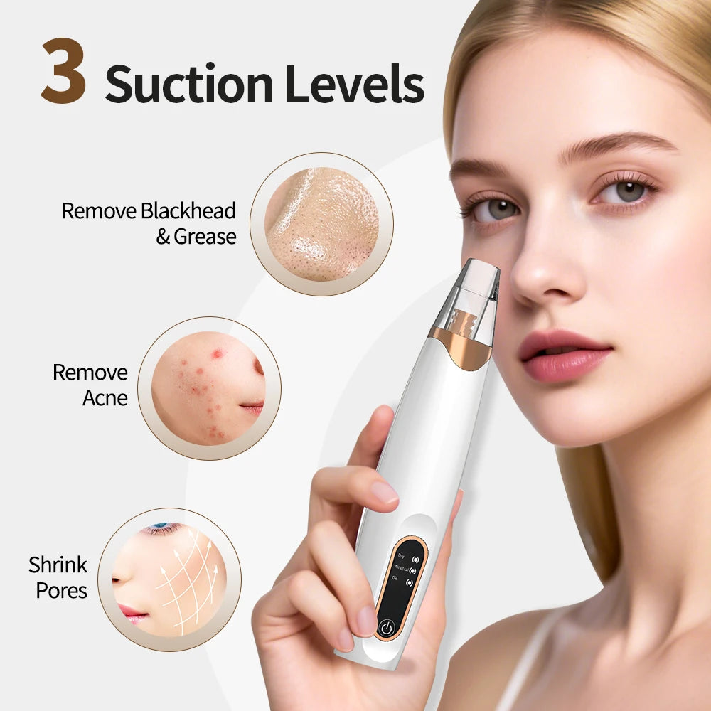 Portable Blackhead Remover Face Nose Pore Cleaner Extractor Face Vacuum Blackhead Removal Skin Care Tool Rechargeable