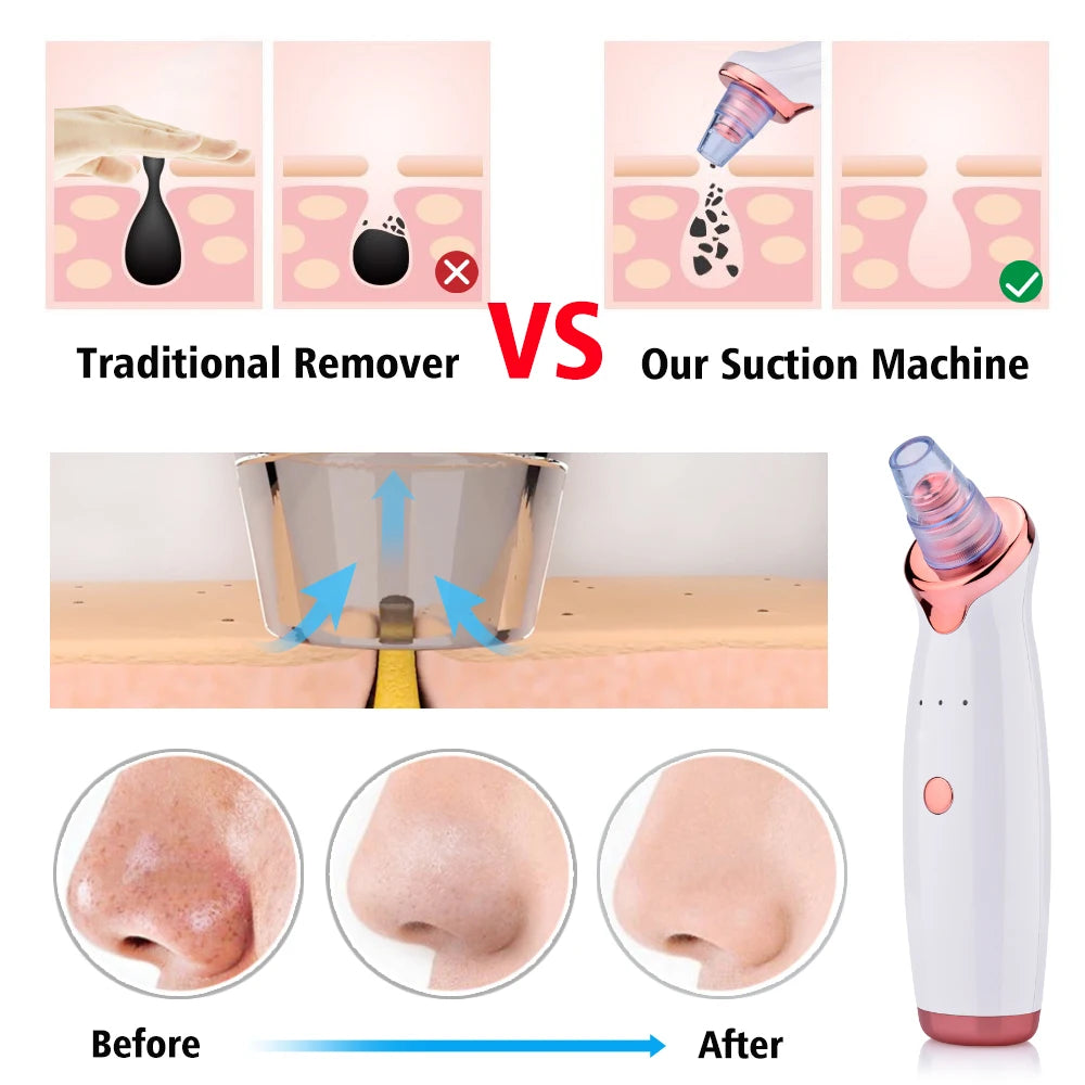 Facial Blackhead Remover Electric Acne Cleaner Blackhead Black Point Vacuum Cleaner Tool Black Spots Pore Cleaner Machine