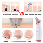 Facial Blackhead Remover Electric Acne Cleaner Blackhead Black Point Vacuum Cleaner Tool Black Spots Pore Cleaner Machine