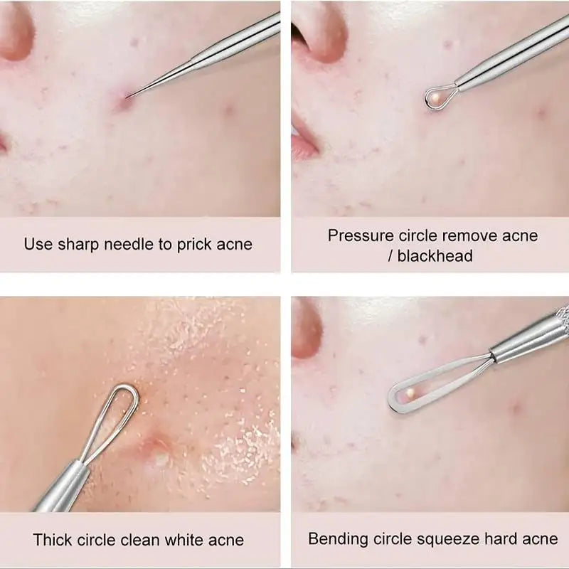 4Pcs/Set Acne Blackhead Needle Set Unscented Blemish PoreCleanser Needle Hook Spot Pimple Remover Skin Care Tools Accessories