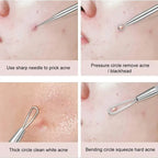 4Pcs/Set Acne Blackhead Needle Set Unscented Blemish PoreCleanser Needle Hook Spot Pimple Remover Skin Care Tools Accessories