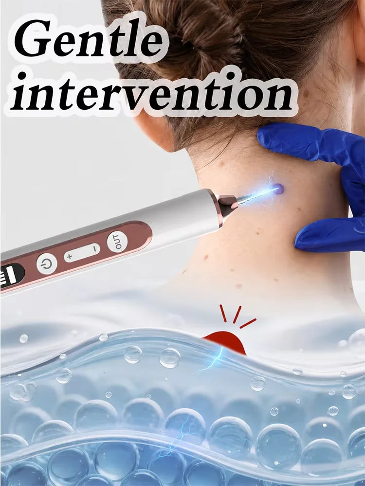 Skin Tag Remover Plasma Pen, Wart Mole Freckle Dark Spot Removal Pen, Electric Beauty Skin Care Device