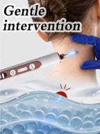 Skin Tag Remover Plasma Pen, Wart Mole Freckle Dark Spot Removal Pen, Electric Beauty Skin Care Device